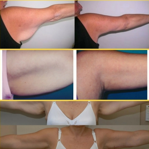 Flabuless - Picture 1 of 3